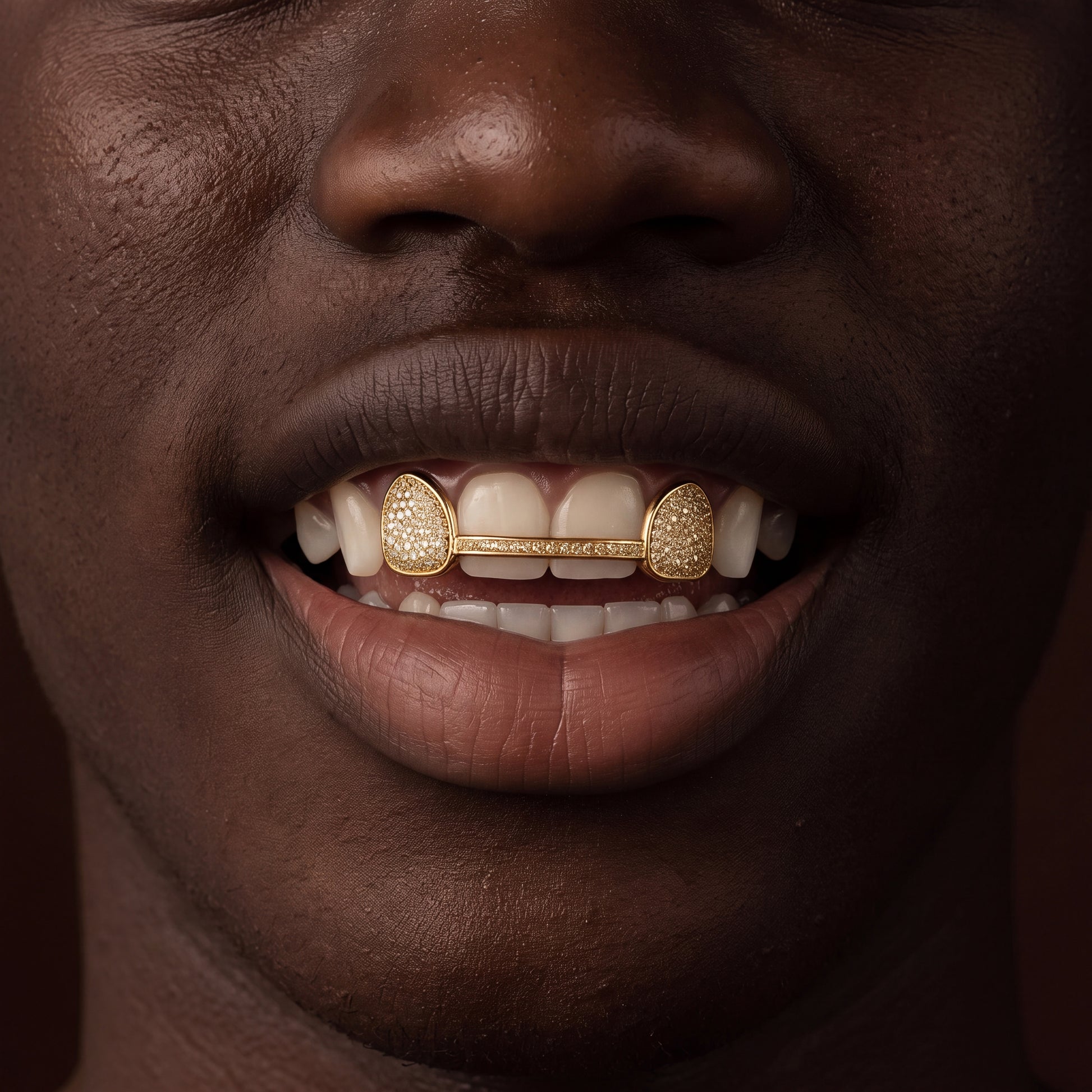 Iced 6 Teeth Connecting Bridge Grillz - Different Drips
